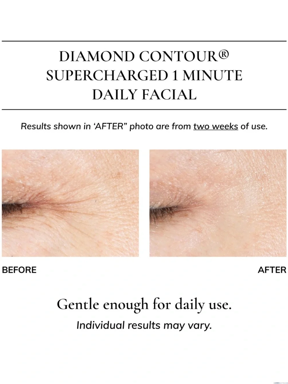 Kaplan MD Diamond Contour 1 Minute Daily Rejuvenating Facial Elixir 1.35/40ml